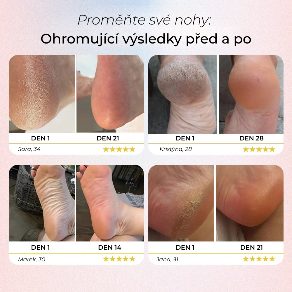 Elektrický odstraňovač mozolů na nohy Yuna